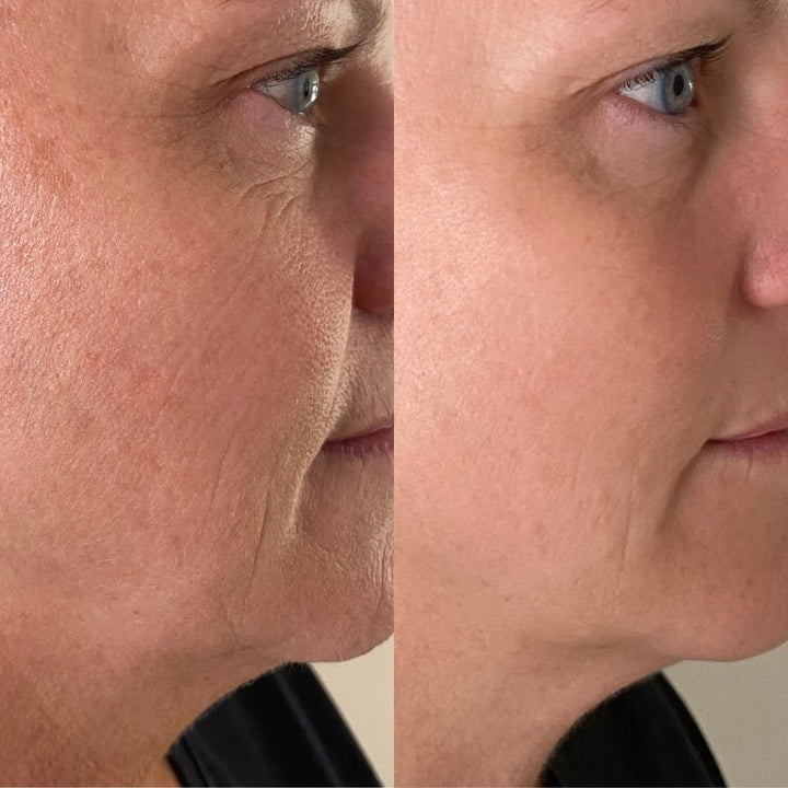 Serum of Plenty 30 ml Before and After