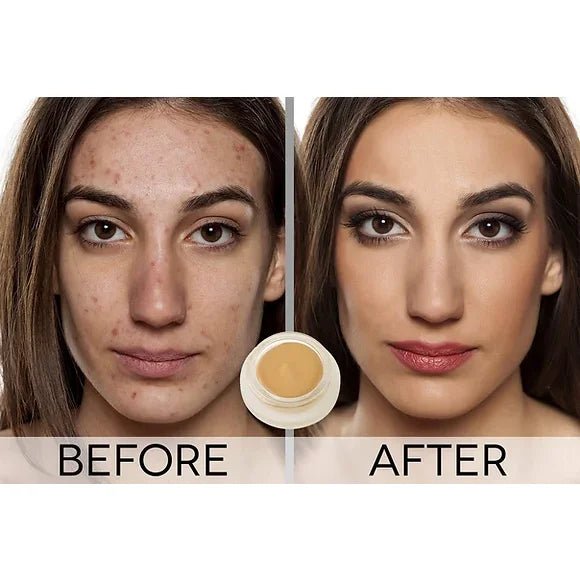 Hynt Duet Concealer - Before  and After