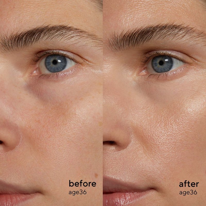 Time Miracle Botanic Retinol Serum Before After