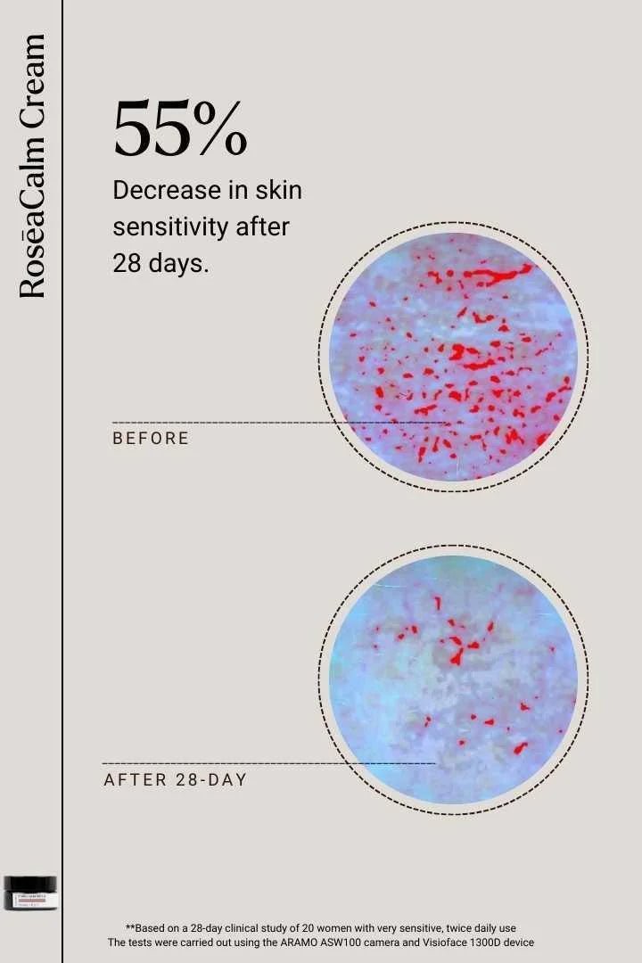 Naya Calm Me RosēaCalm Creme - Sensibilität Klinische Studie