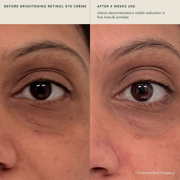 Ranavat Brightening Retinol Eye Crème Radiant Rani Before After