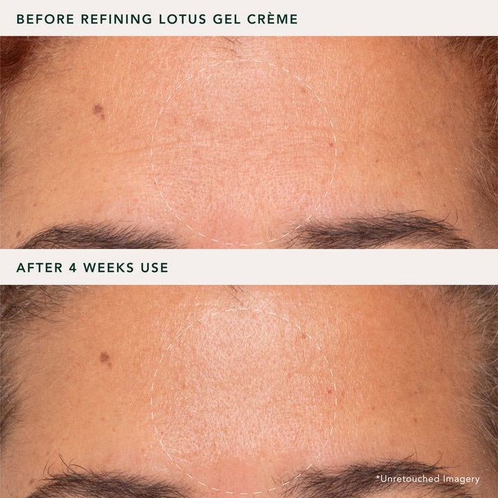 Ranavat Refining Lotus Gel-Crème - Real Results